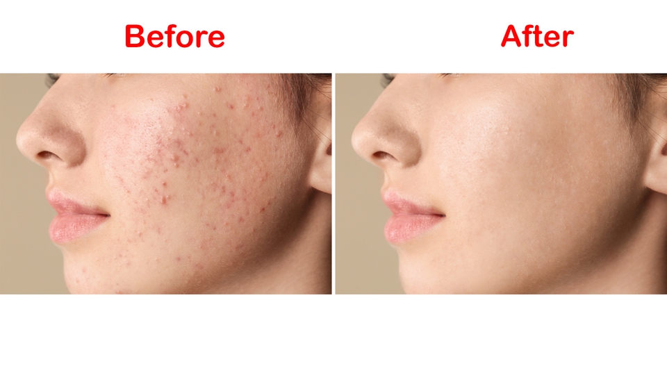 ไดคัท & Photoshop - ไดคัทภาพ > รีทัชภาพ > เปลี่ยนสีผิว > แต่งภาพ > ลบสิ่งที่ไม่ต้องการออกจากภาพ > ทำภาพตัดแปะ - 9