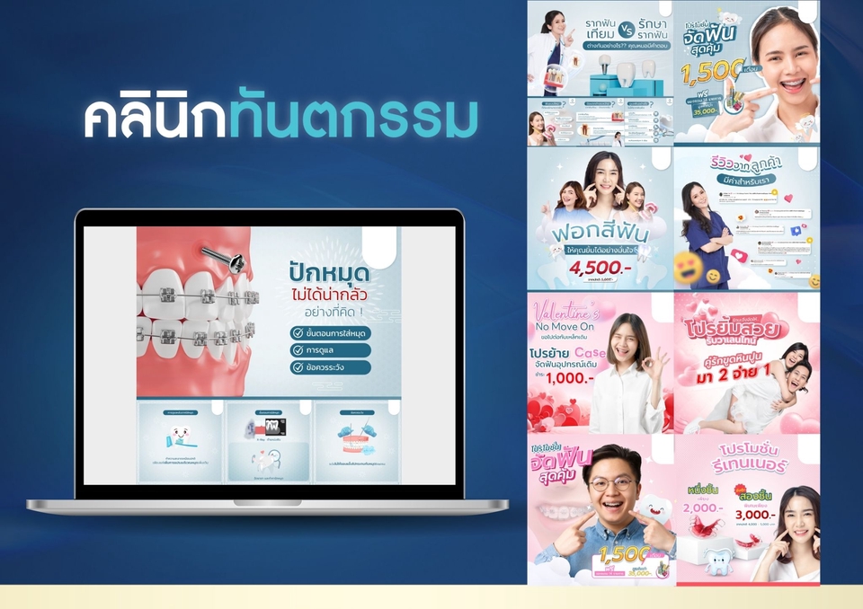 รับทำโฆษณาเฟสบุ๊คและIG โฆษณาติ๊กต๊อก ยิงแอด facebook ราคาถูก