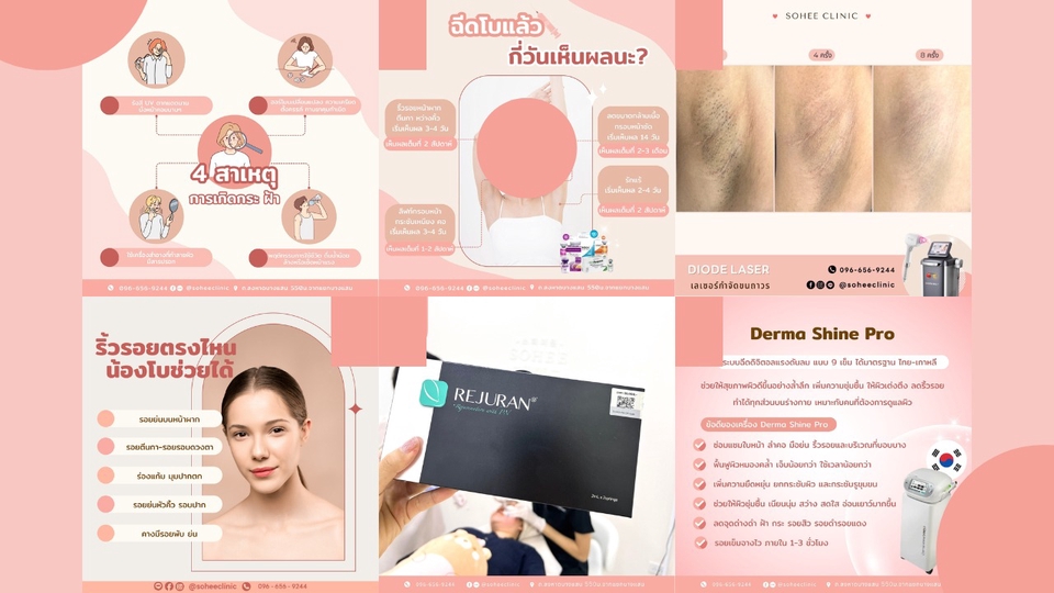 Banner โฆษณา - ออกแบบสื่อโฆษณา Artwork, Banner, Content, Post Design, Promotion Online (Facebook,Line,Instagrams) - 1
