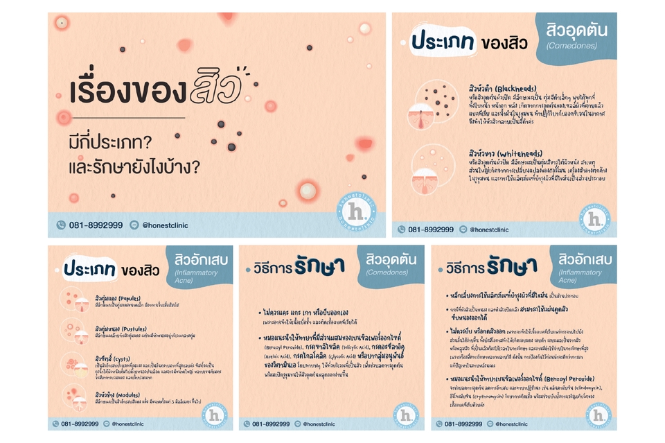 ออกแบบแบนเนอร์เว็บไซต์ สิวรักษา โฆษณาคลินิก