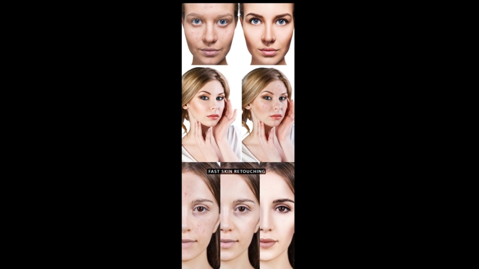 Edit Gambar & Photoshop - Skin retouching / menghilangkan jerawat di foto - 2