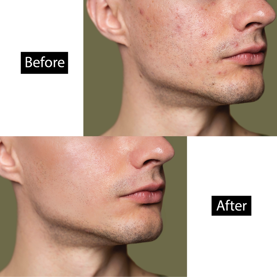 ไดคัท & Photoshop - Dicut, Retouch (ไดคัท,รีทัชภาพ,เปลี่ยนพื้นหลัง) - 4