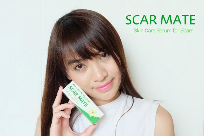 รีวิวเซรั่ม Scar Mate สำหรับรอยแผลเป็น บอกเล่าประสบการณ์การใช้