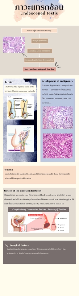 Infographics - รับออกแบบ Infographic ราคาถูก งานเสร็จภายในสามวัน - 3