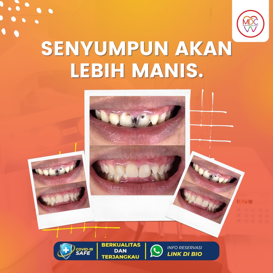 Digital Marketing - JASA KELOLA MEDIA SOSIAL INSTAGRAM & FACEBOOK - 6