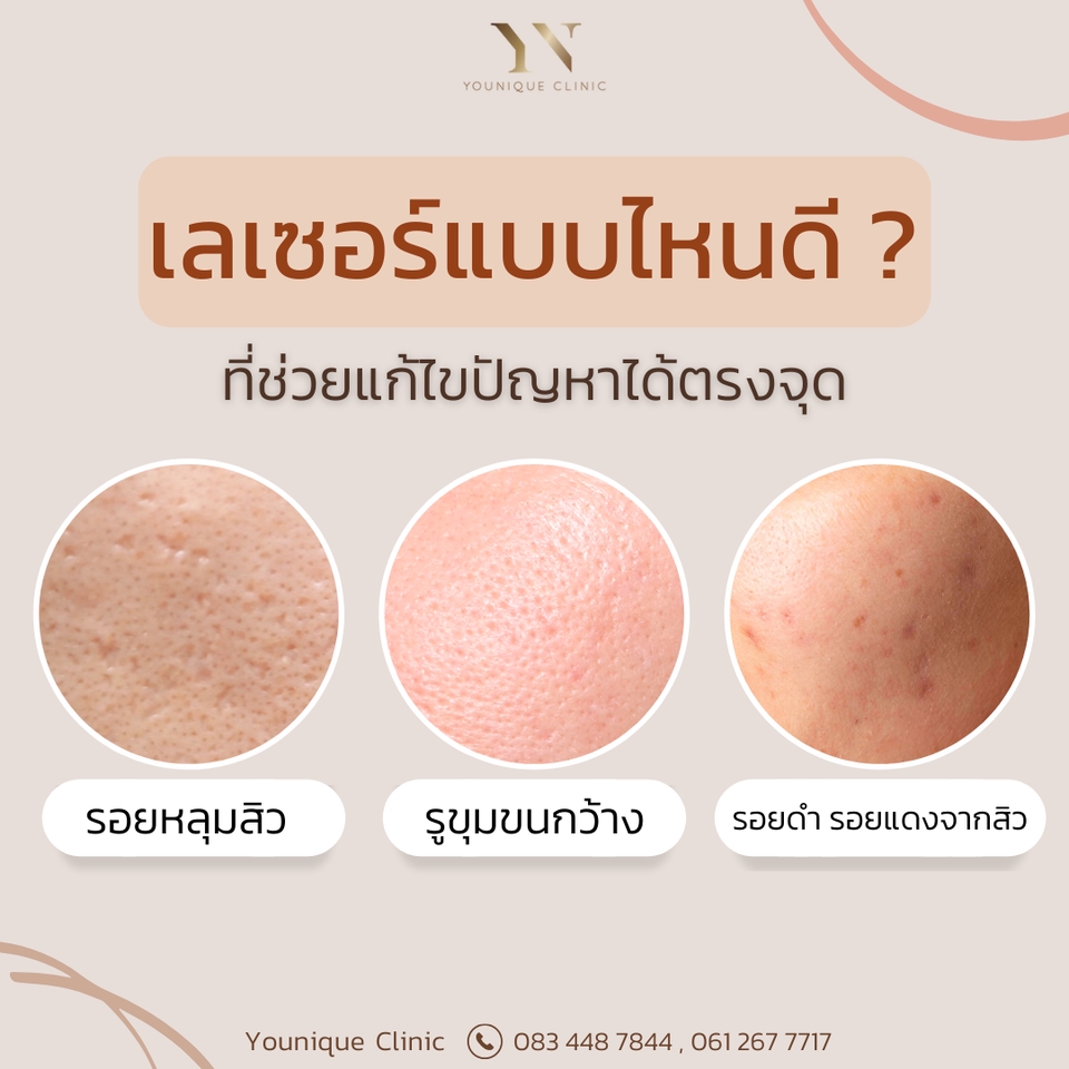 โปรโมทเพจ / เว็บ - คิดแคปชั่น เขียนคอนเทนต์ สื่อสารให้ลูกค้าเข้าใจ ชัดเจน ตัดสินใจง่ายขึ้น - 8
