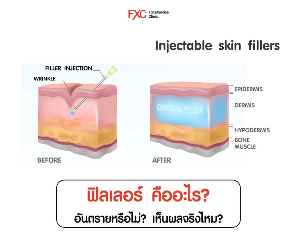 Banner โฆษณา - Minimal, Modern, etc - 6