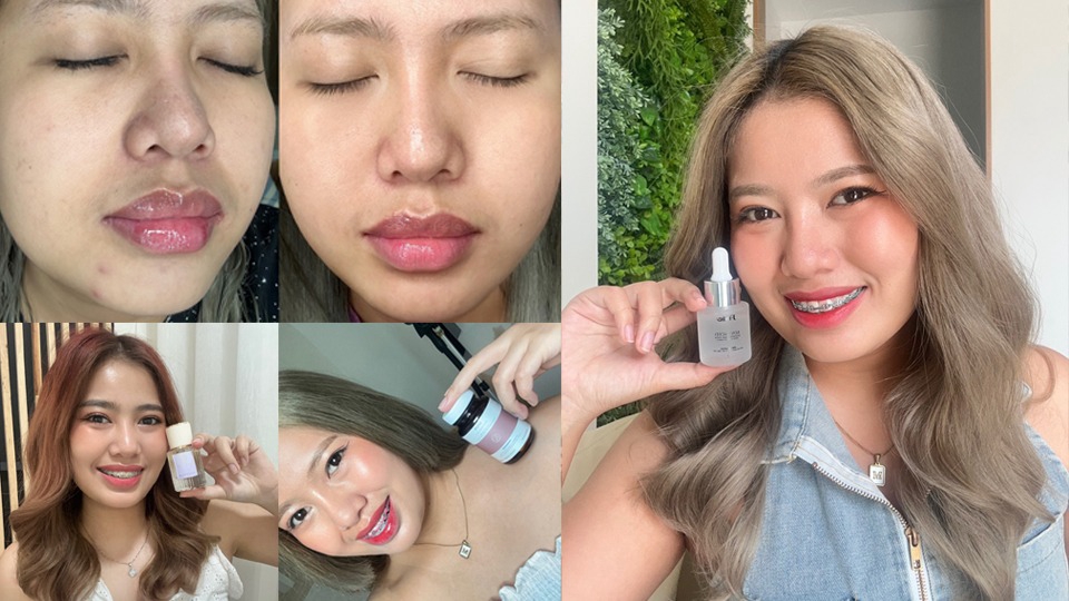 เขียนรีวิว - Review Lemon,IG,Before+After - 1