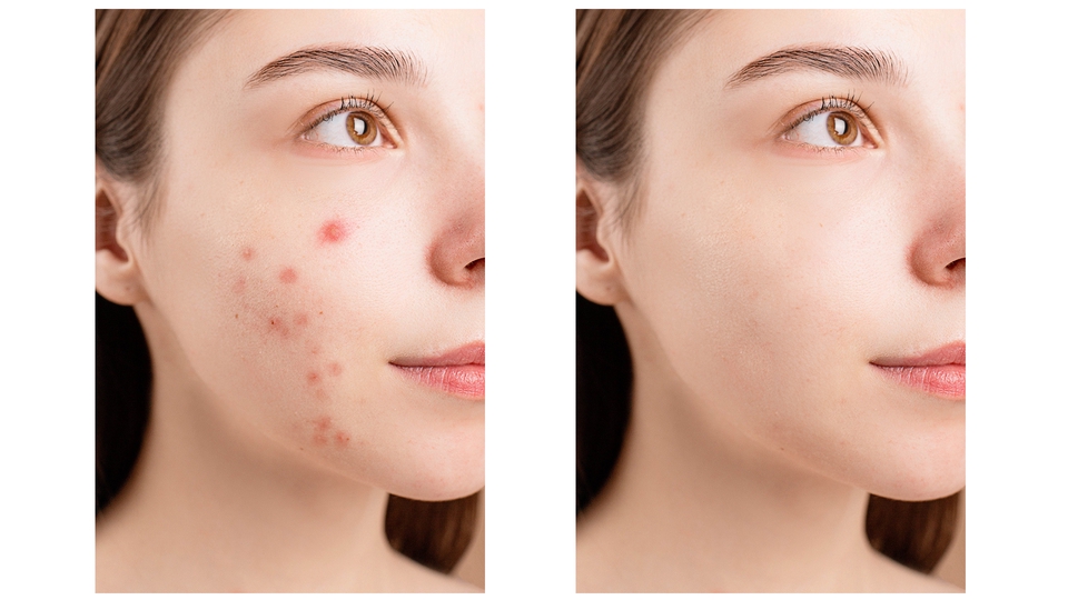 ไดคัท & Photoshop - รับ รีทัช/ไดคัท ( Retouch/Dicut ) สิ่งของวัตถุ ออกจากภาพ - 8