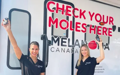 Mole Mobile Skin Cancer Screenings