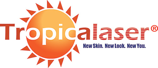 Tropicalaser Laser Hair Removal Franchise