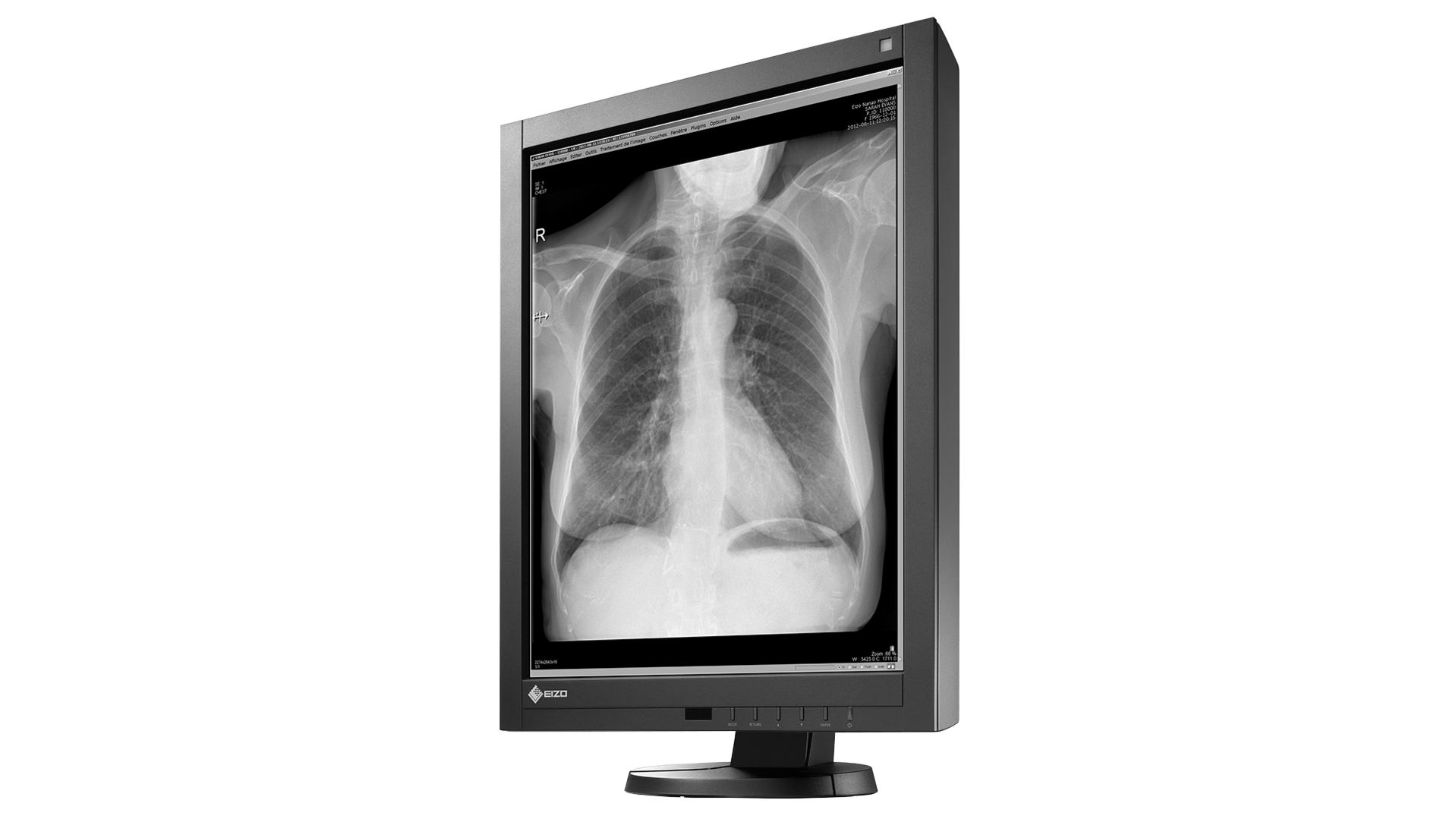 EIZO RadiForce GX340 21.3 INCH IPS MEDICINE PAIRING WITH EIZO RadiForce GX340 21.3 INCH IPS MEDICINE PAIRING WITH