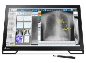 EIZO RadiForce MS236WT-A 23 INCH IPS MEDICINE BLACK *จอคอมพิวเตอร์