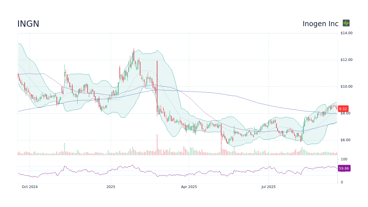 INGN Stock Price - Inogen Inc Stock Candlestick Chart - StockScan