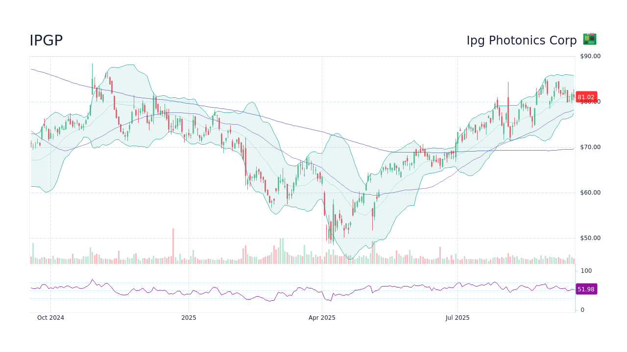 IPGP Stock Price - Ipg Photonics Corp Stock Candlestick Chart - StockScan