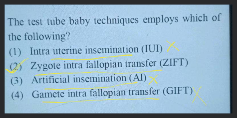 Gamete And Zygote Intrafallopian Transfer (GIFT And ZIFT) - Health Library  | NewYork-Presbyterian