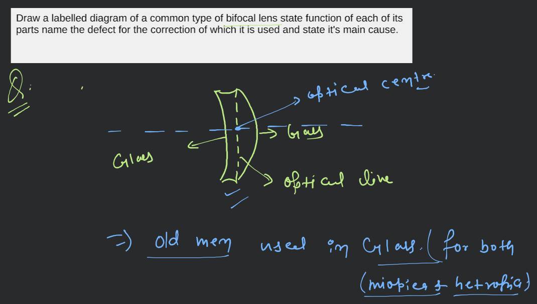 Draw a labelled diagram of a common type of bifocal lens state function o..