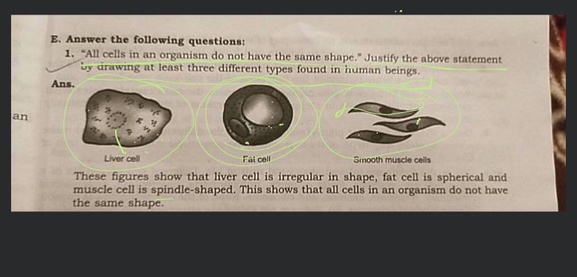 Different shape of smooth muscle cells under different condition