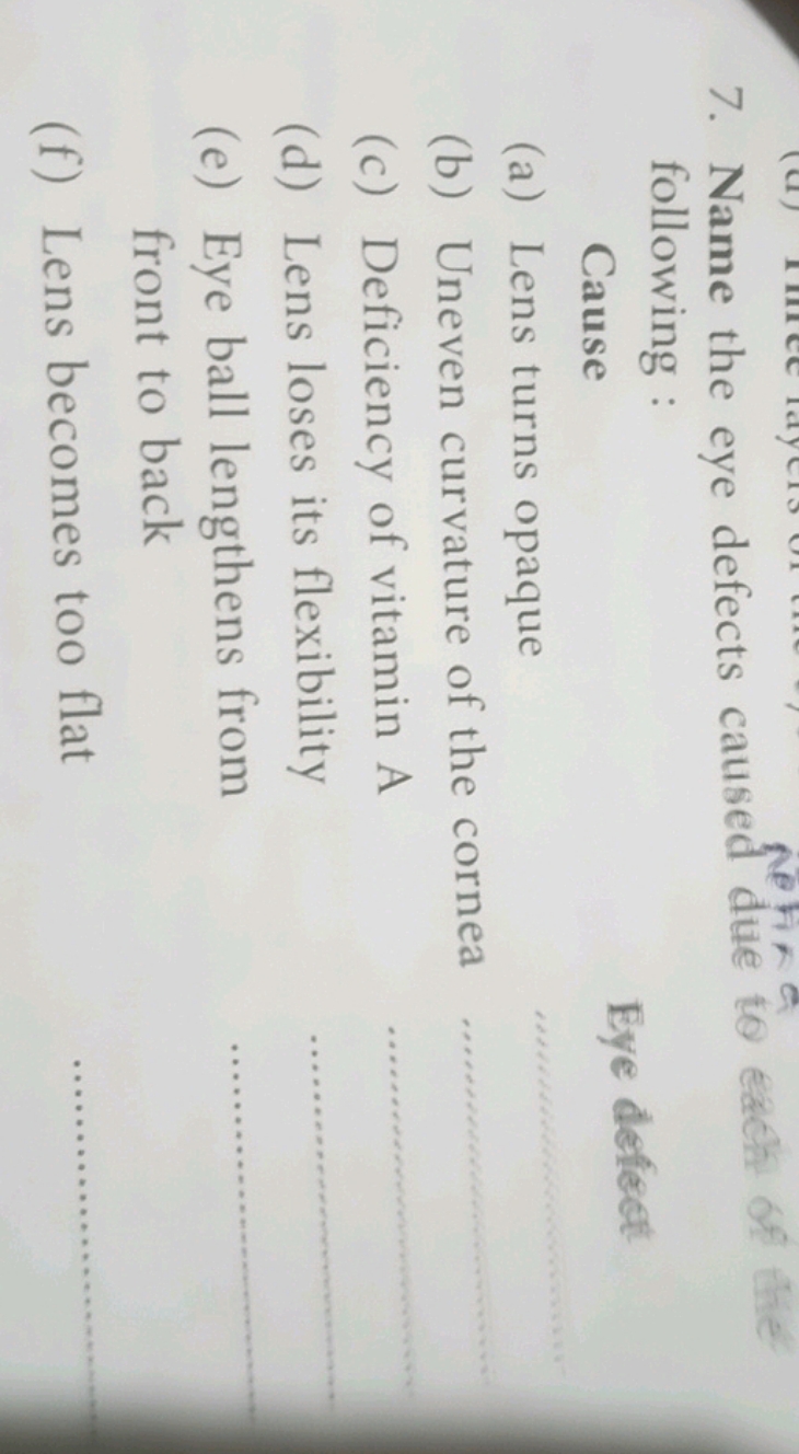 7. Name the eye defects caused due to each of the following :

Cause (