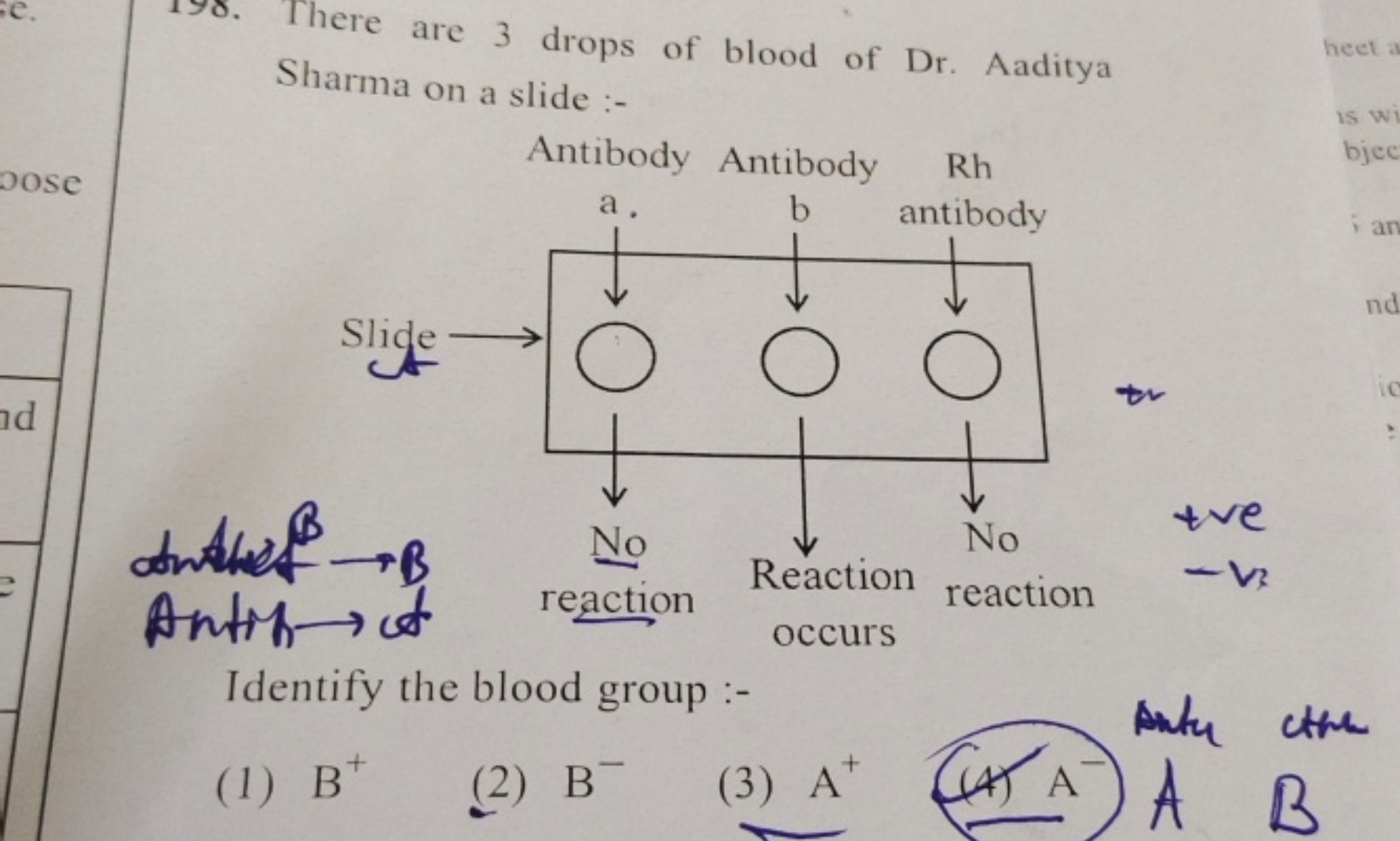 198. There are 3 drops of blood of Dr. Aaditya Sharma on a slide :-

A