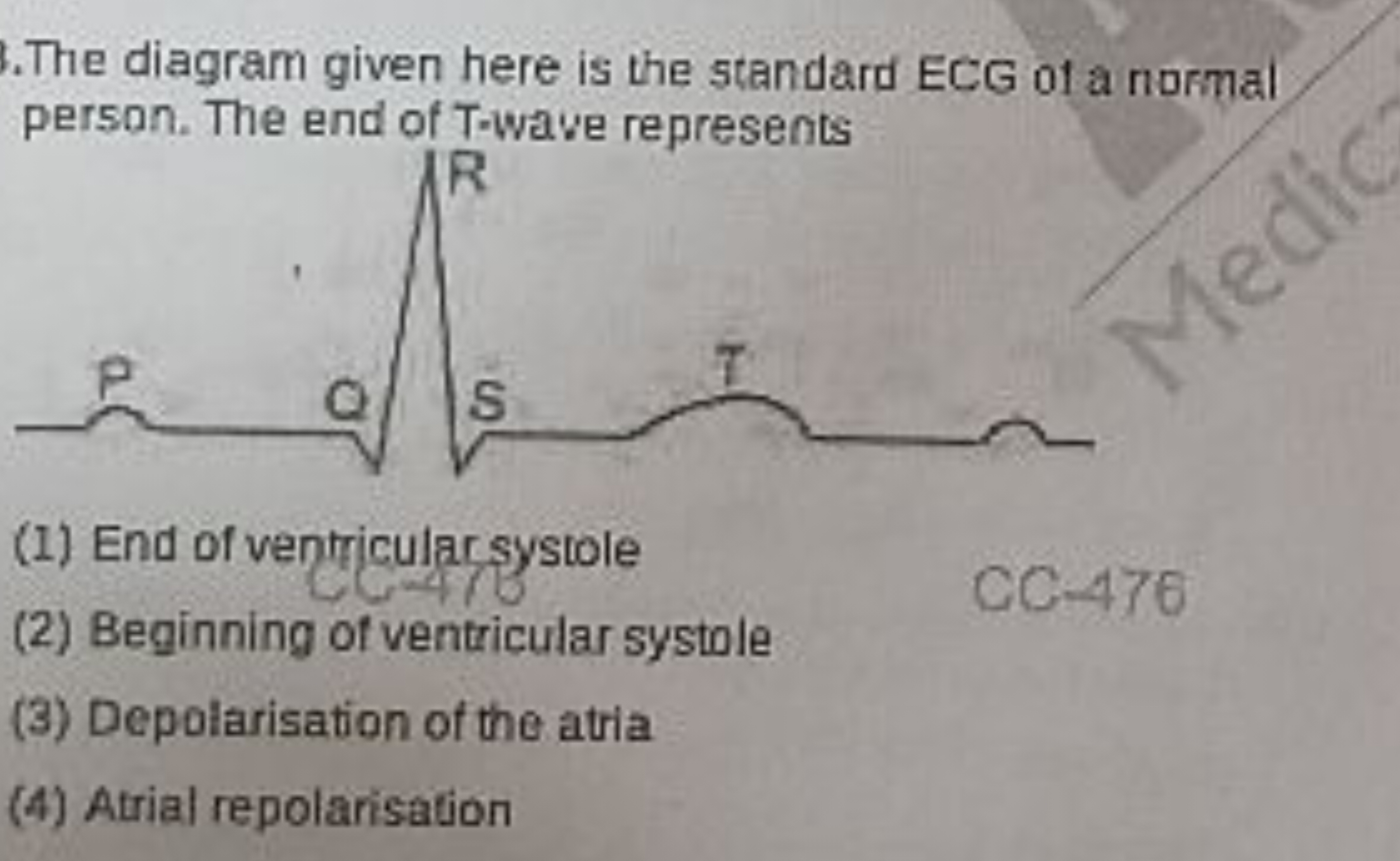 The diagram given here is the standard ECG of a normal person. The end