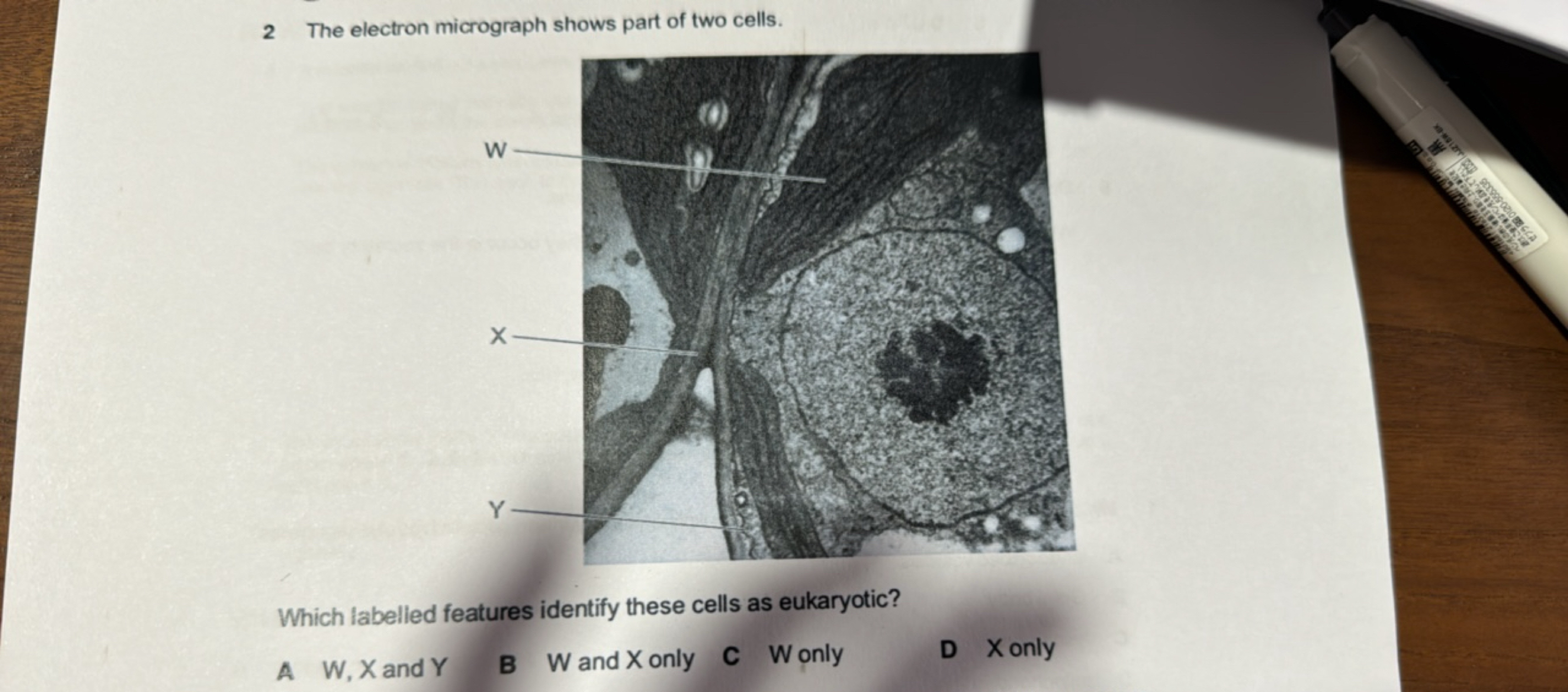 2 The electron micrograph shows part of two cells.

Which labelled fea