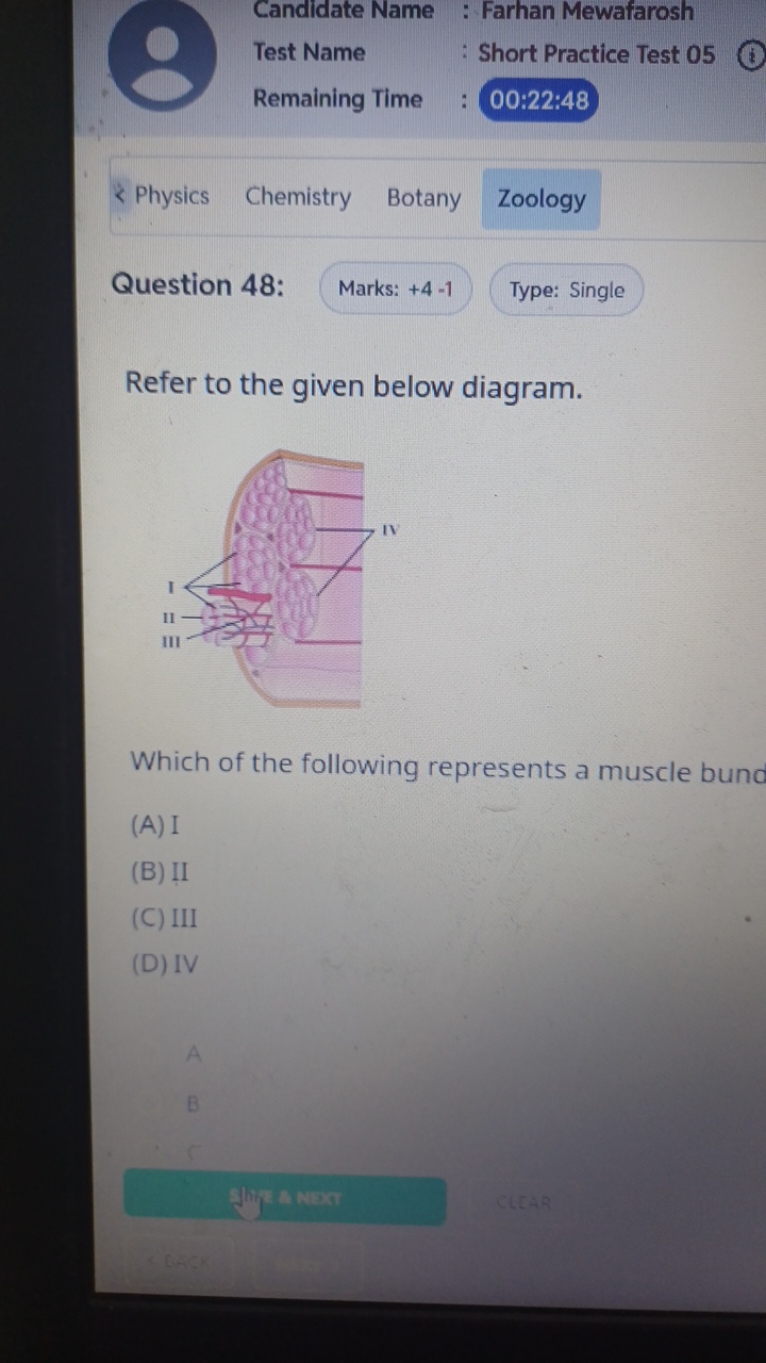 0
Candidate Name : Farhan Mewafarosh
Test Name : Short Practice Test 0