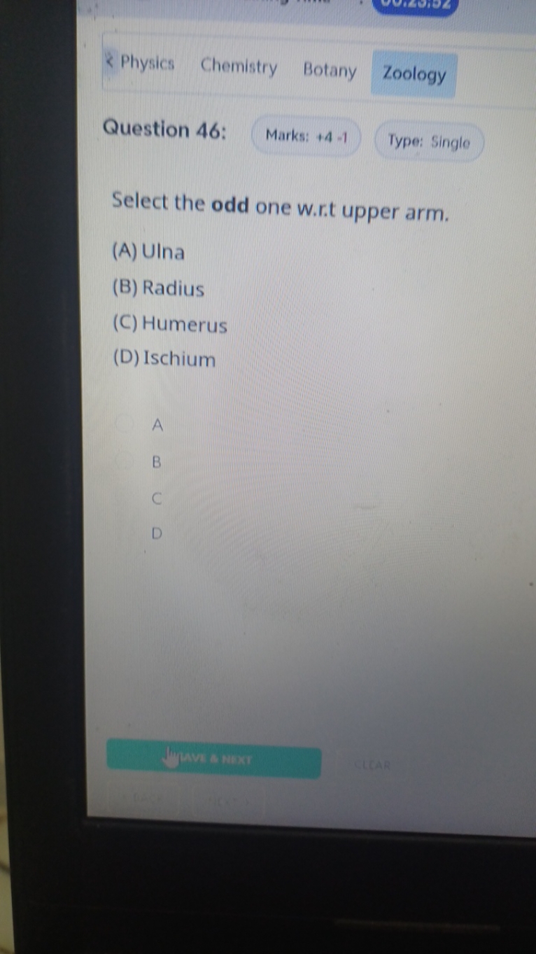 Physics
Chemistry
Botany
Zoology

Question 46:
Marks: + 4 -1
Type: Sin