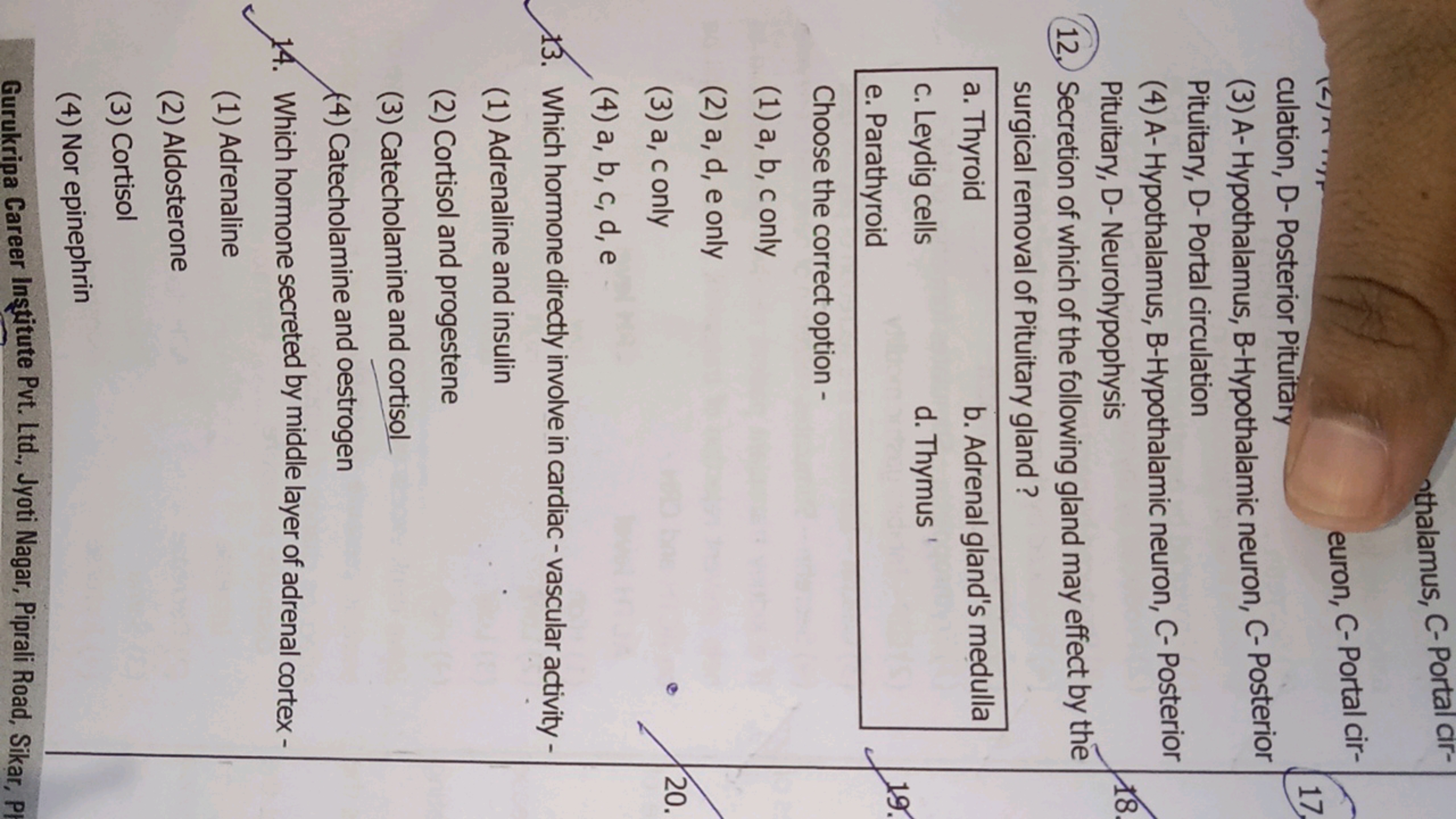 othalamus, C- Portal Cir-
euron, C- Portal cir-
culation, D- Posterior