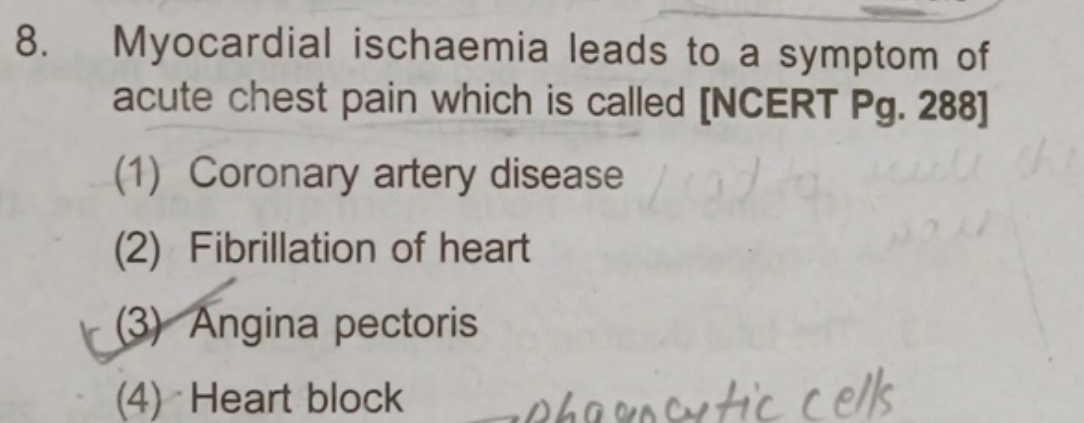 8. Myocardial ischaemia leads to a symptom of acute chest pain which i