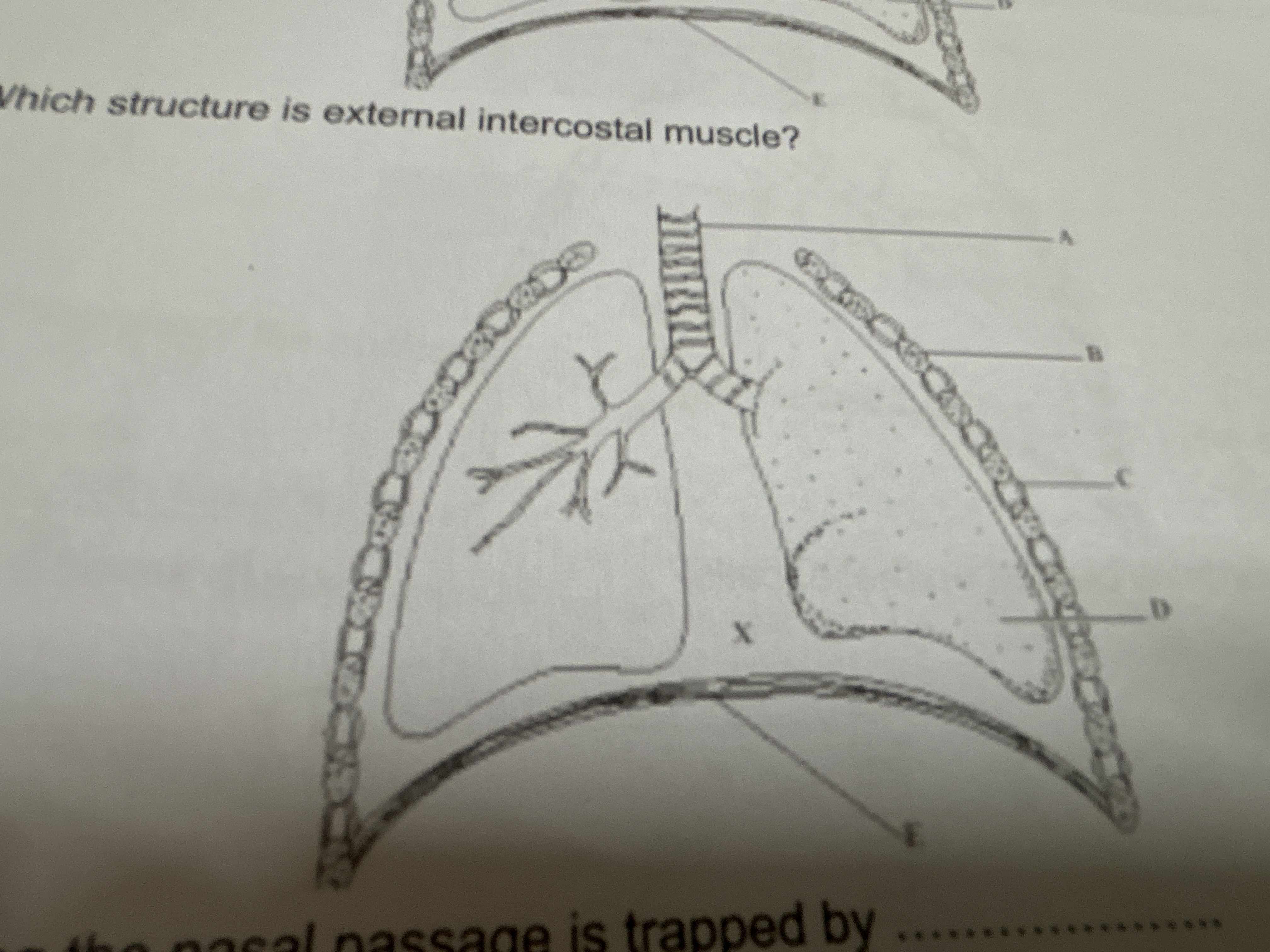 Which structure is external intercostal muscle?