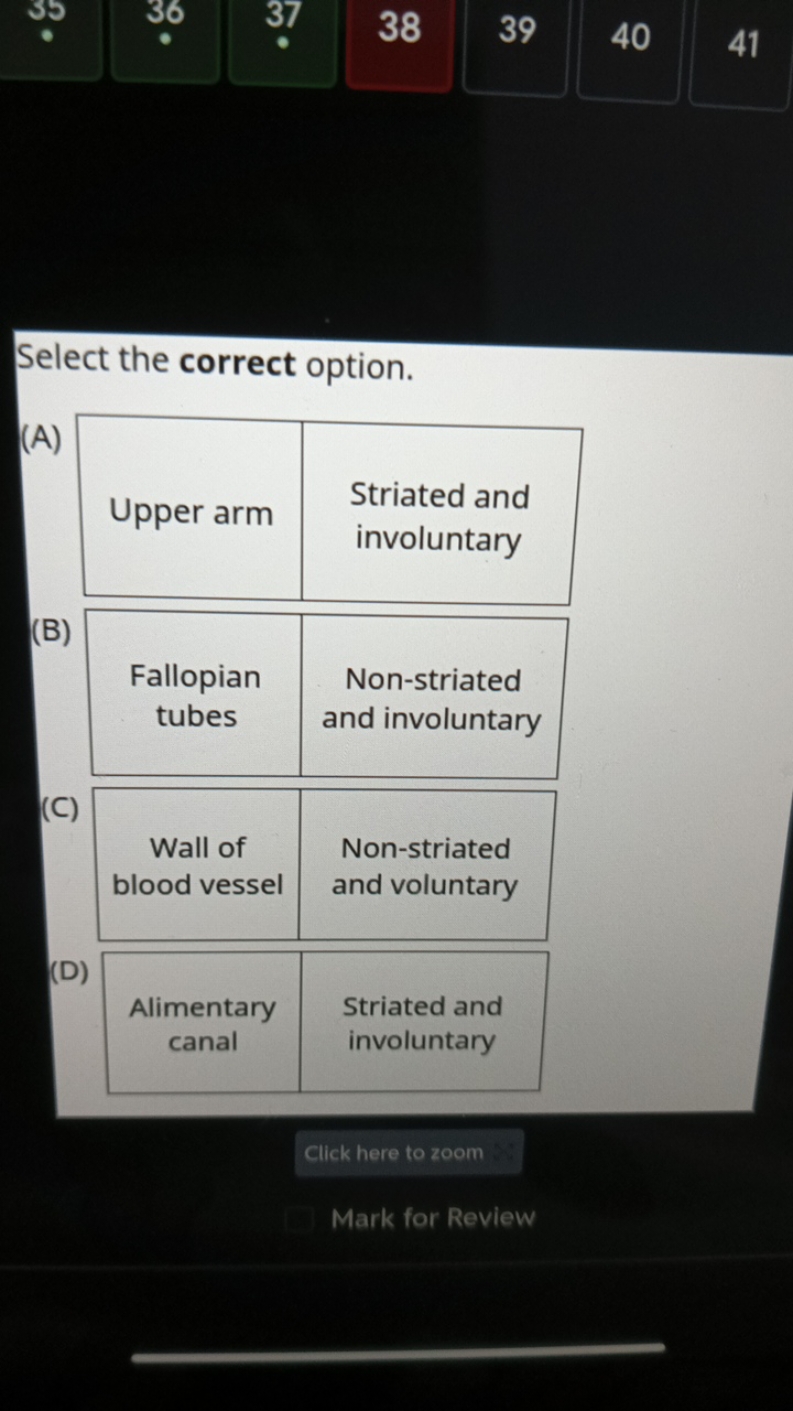 Select the correct option.
(A)
\begin{tabular} { | l | l | } 
\hline U