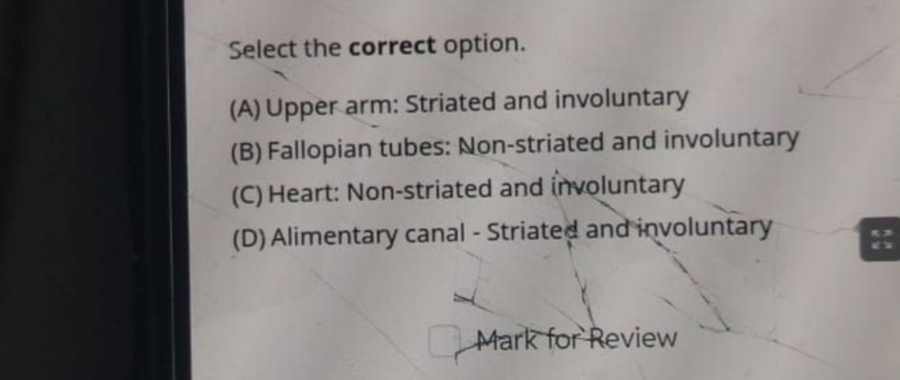 Select the correct option.
(A) Upper arm: Striated and involuntary
(B)