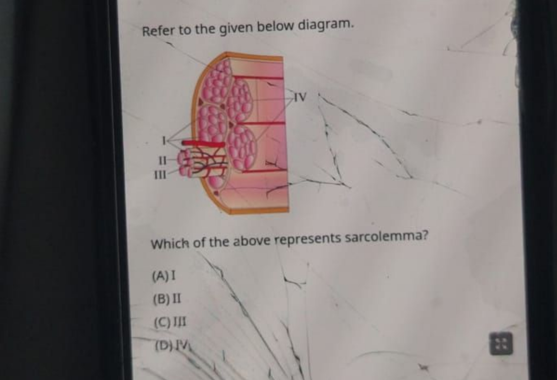 Refer to the given below diagram.

Which of the above represents sarco