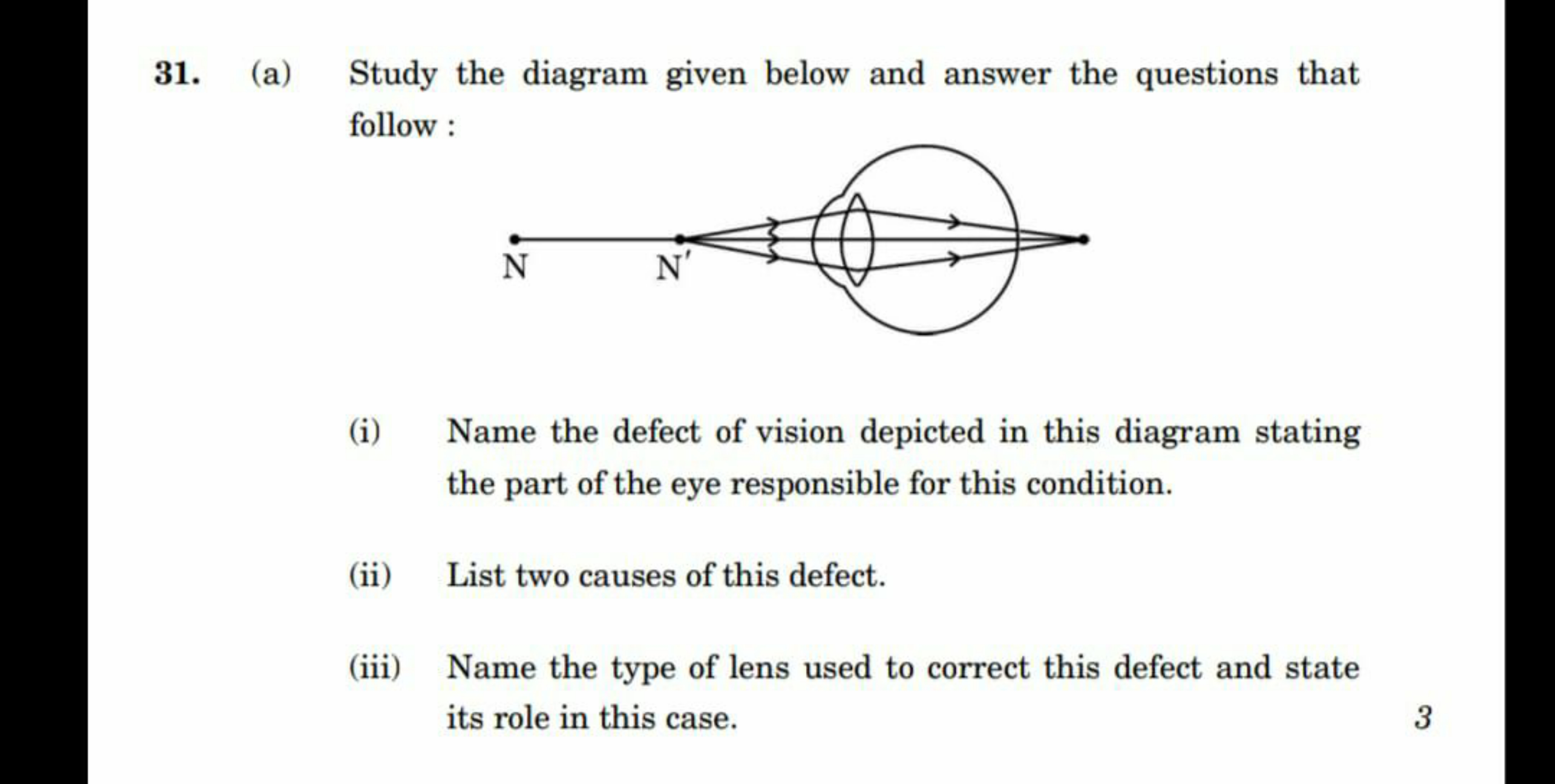 31. (a) Study the diagram given below and answer the questions that fo