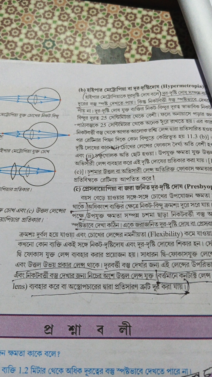 
মद্টোপিয়া যুক্ত চোঢের নিকট বিन্দू
ইপার অম্্ৈোপিয়া যুক্ত চোখ
পিয়ার 