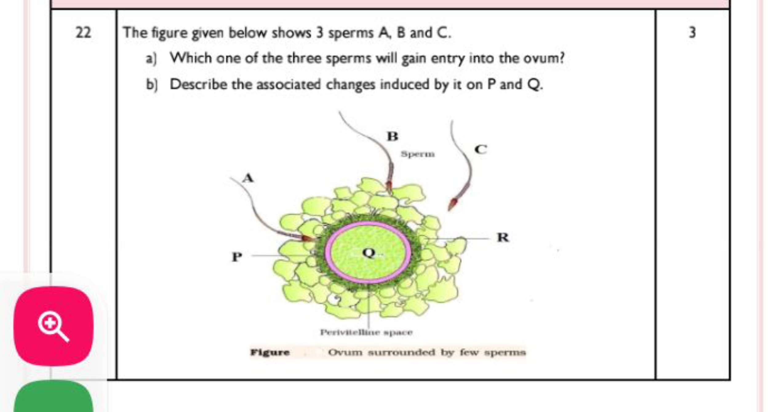 22 The figure given below shows 3 sperms A, B and C.
a) Which one of t