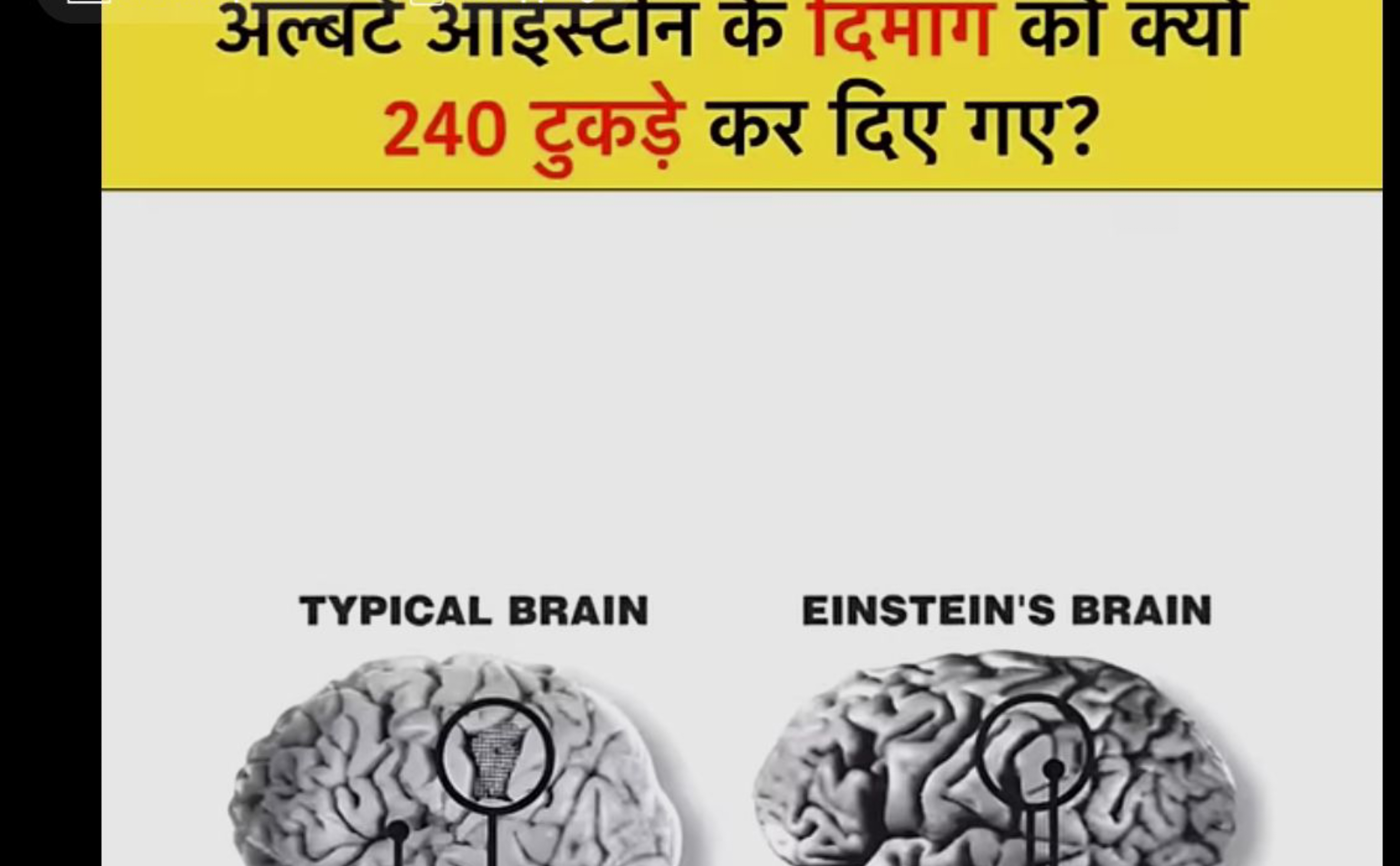 अल्बट आइस्टान के दमाग का क्या 240 टुकड़े कर दिए गए?

TYPICAL BRAIN
EIN