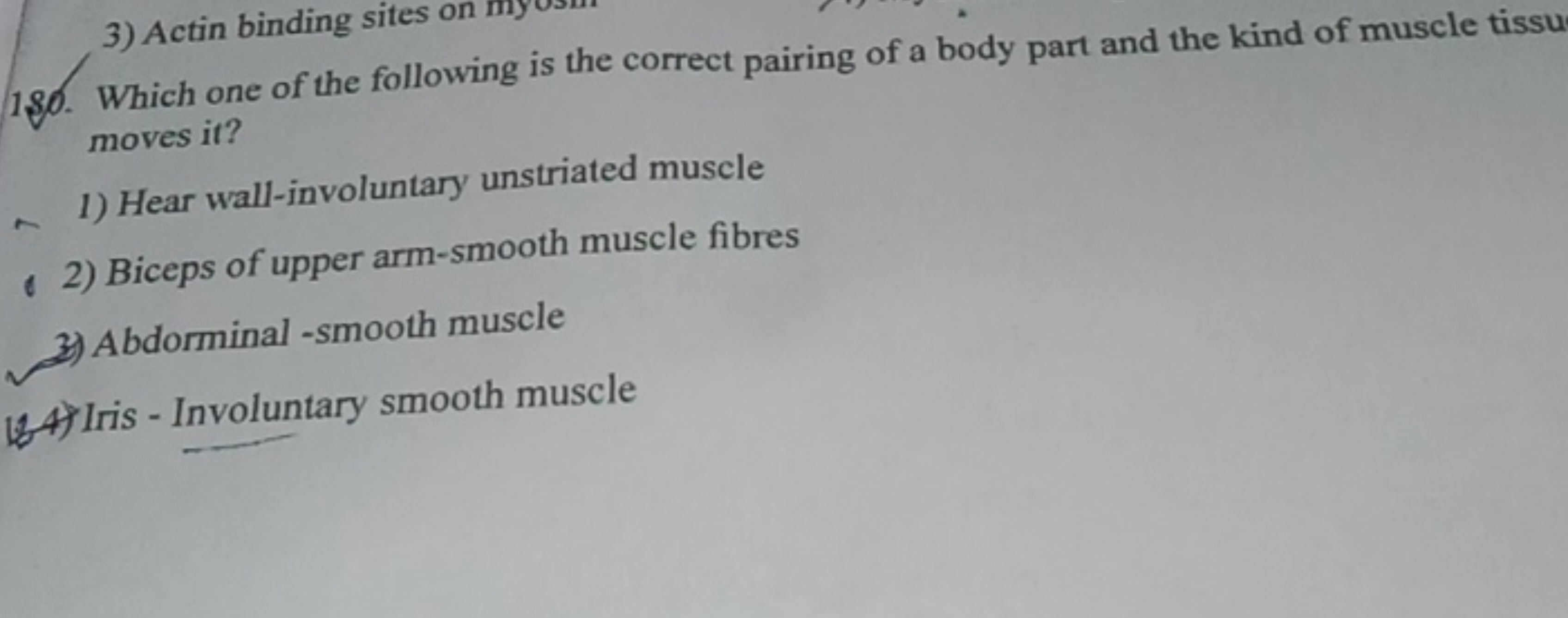 180. Which one of the following is the correct pairing of a body part 