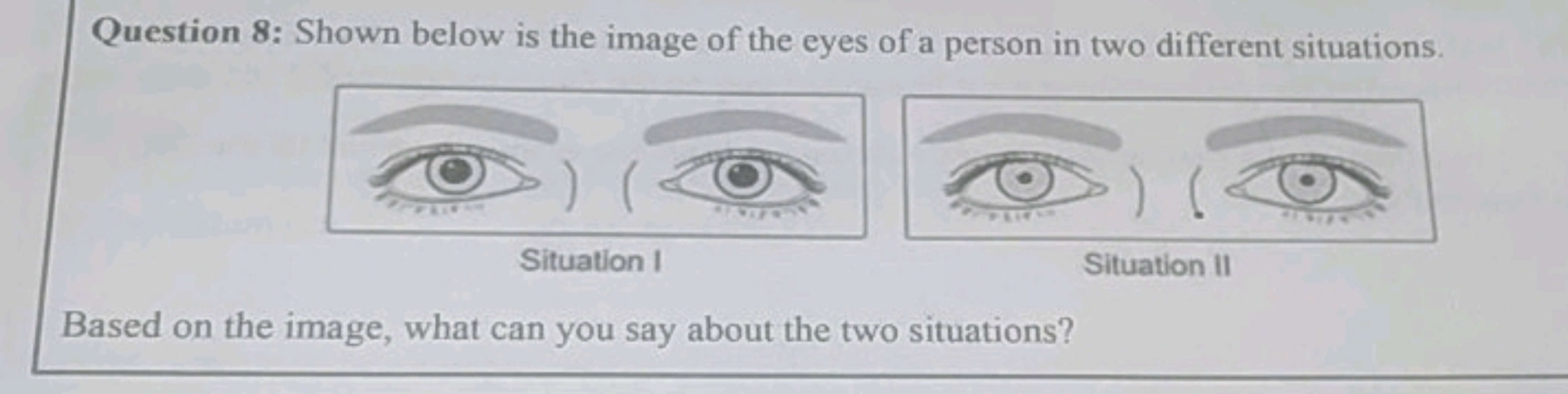 Question 8: Shown below is the image of the eyes of a person in two di