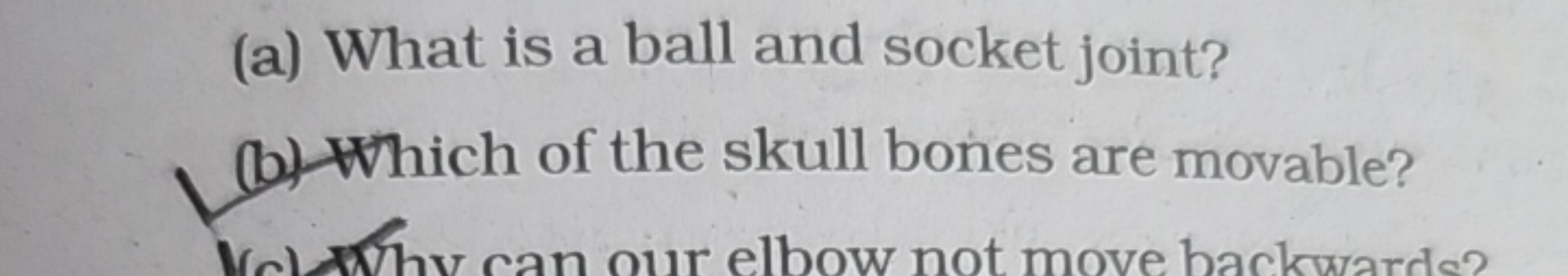 (a) What is a ball and socket joint?
(b) Which of the skull bones are 