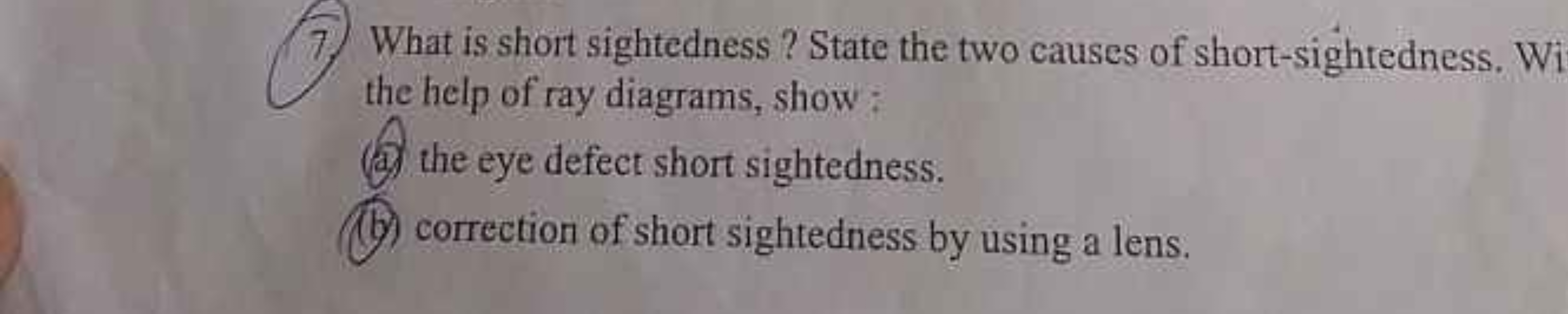 7. What is short sightedness ? State the two causes of short-sightedne