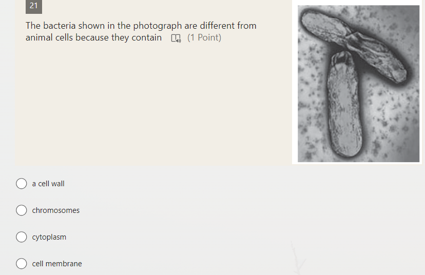 21
The bacteria shown in the photograph are different from animal cell