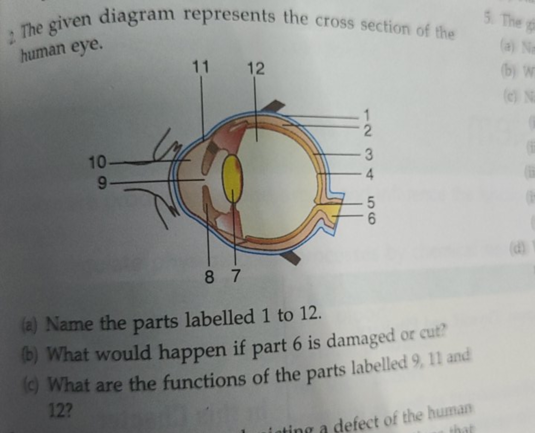 2 The given diagram represents the cross section of the human eye.
(a)