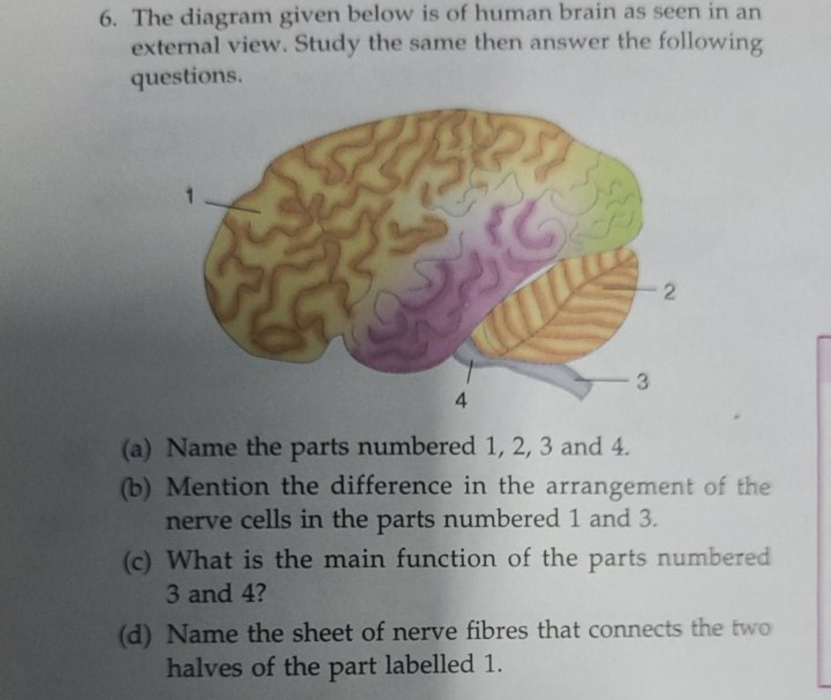 6. The diagram given below is of human brain as seen in an external vi