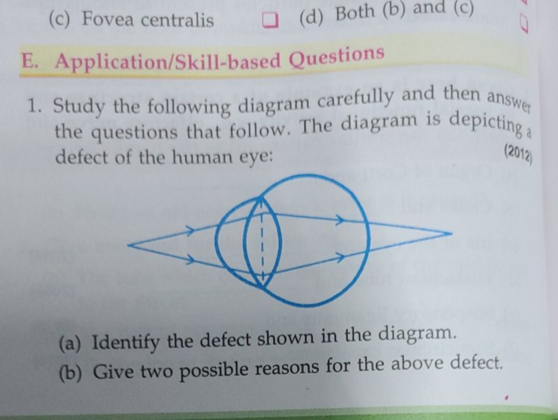 (c) Fovea centralis
(d) Both (b) and (c)
E. Application/Skill-based Qu