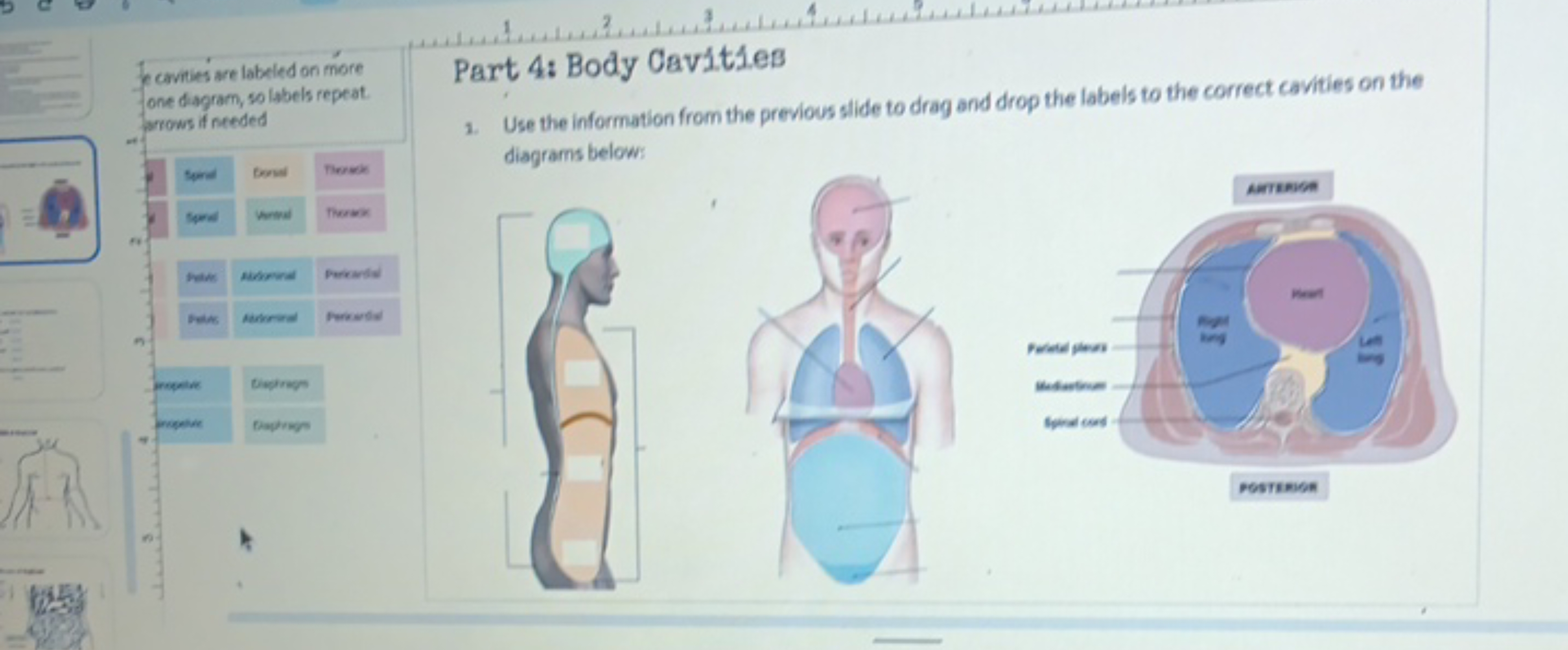 ANTERIOR
cavities are labeled on more
one diagram, so labels repeat.
a