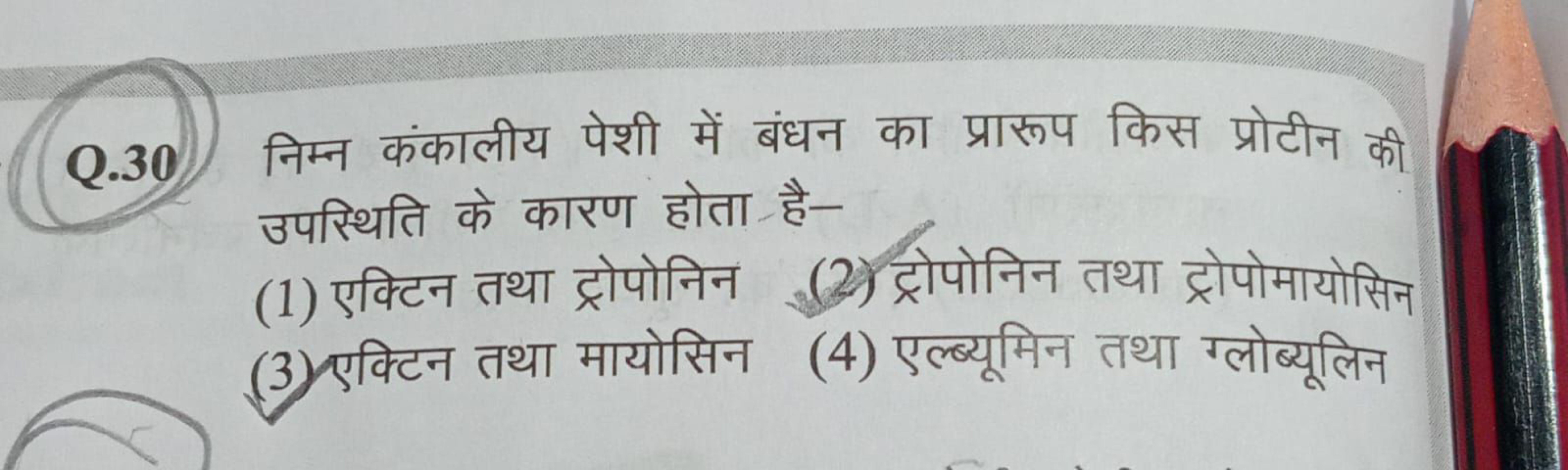 Q.30 निम्न कंकालीय पेशी में बंधन का प्रारूप किस प्रोटीन की उपस्थिति के