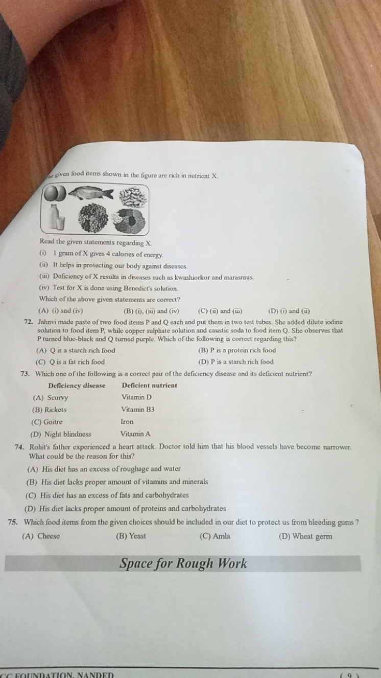 he given food items shown in the figure are rich in nutrient X .

Read