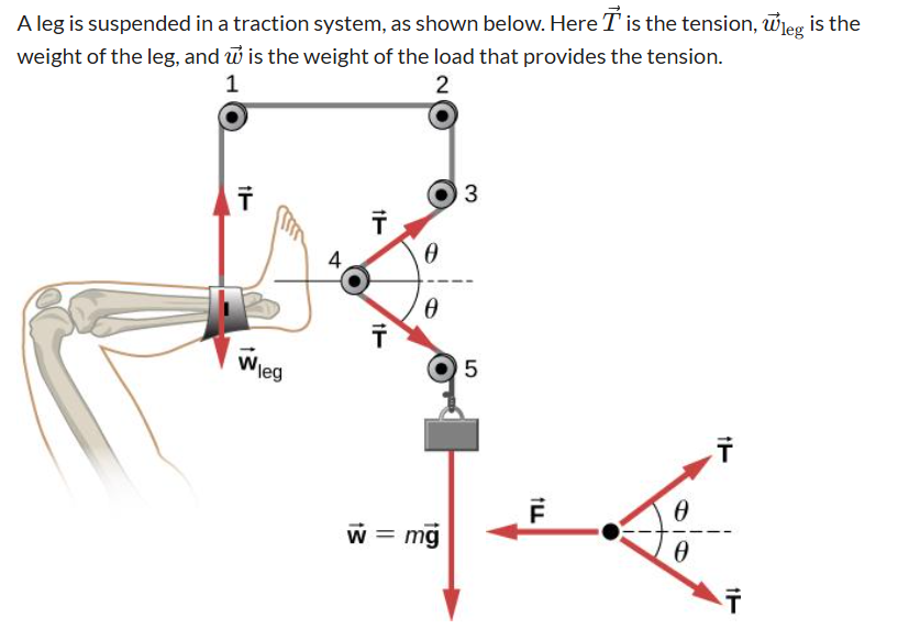A leg is suspended in a traction system, as shown below. Here T is the te..